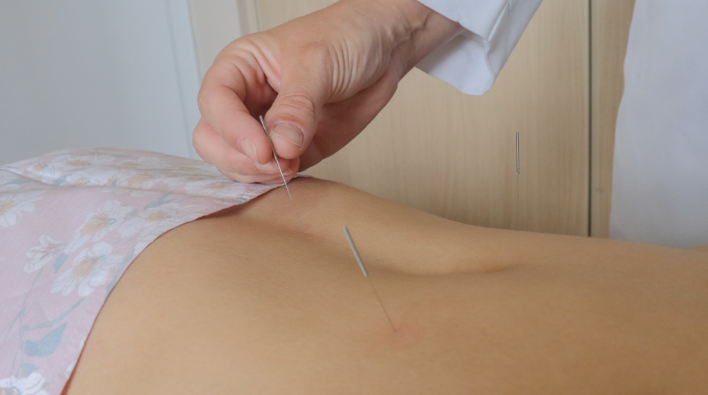 Clínica-Cursos-Acupuntura