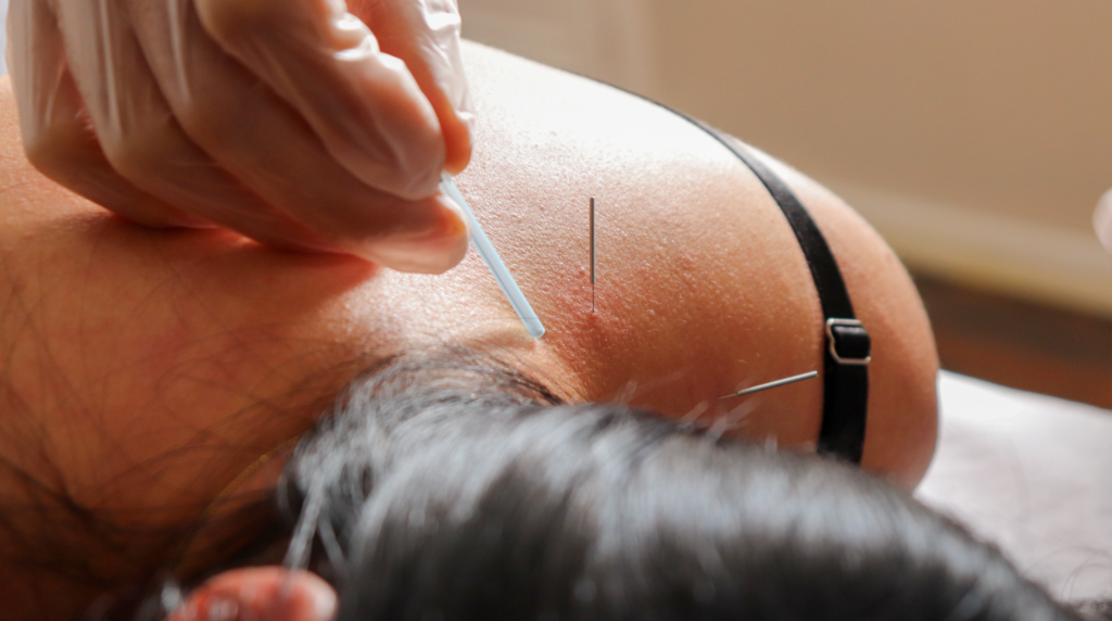 Clínica-Cursos-Dry-needling